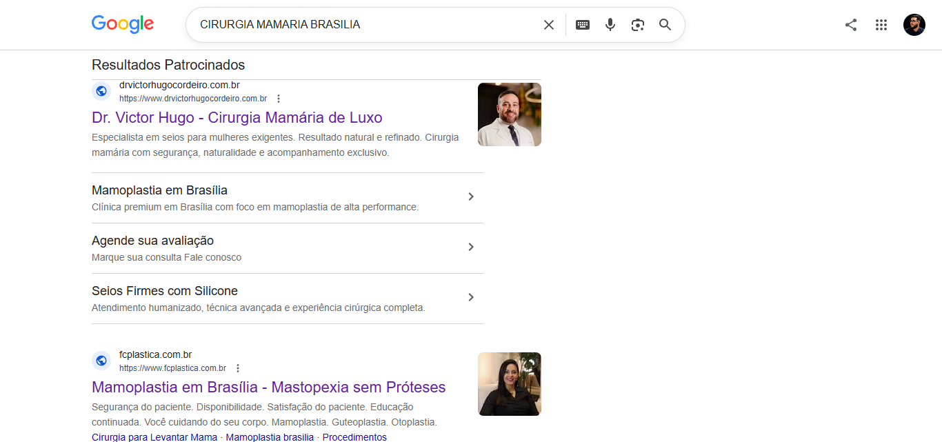 Resultados patrocinados no Google para a busca cirurgia mamaria brasilia